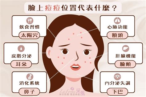 長痘痘位置|痘痘一直好不了？痘痘位置代表什麼？醫師2招治療痘。